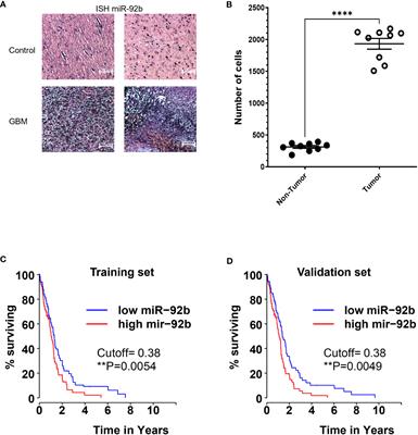 MicroRNA-92b targets tumor suppressor gene FBXW7 in glioblastoma